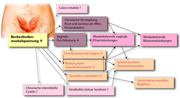 klinische und sexologische Folgen der hohen Beckenbodenmuskelspannung